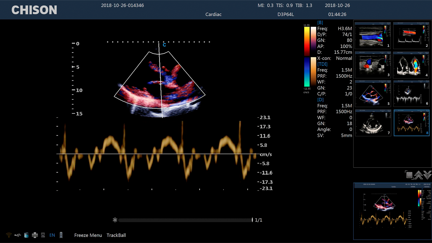CBit 4 Cardiac TDI PW